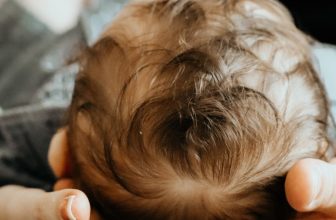 Babybedje: symptomen, oorzaken, behandelingen, veelgestelde vragen